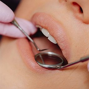 Close up of woman’s mouth in dental mirror