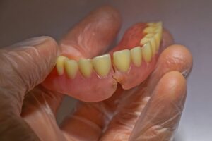 gloved hand holding broken denture